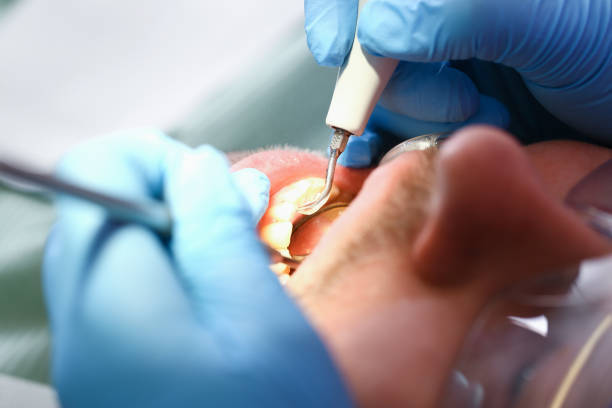 Best Cracked Tooth Emergency Dentist  in Big Bend, WI