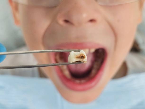 Best Dentist for Severe Toothache  in Big Bend, WI